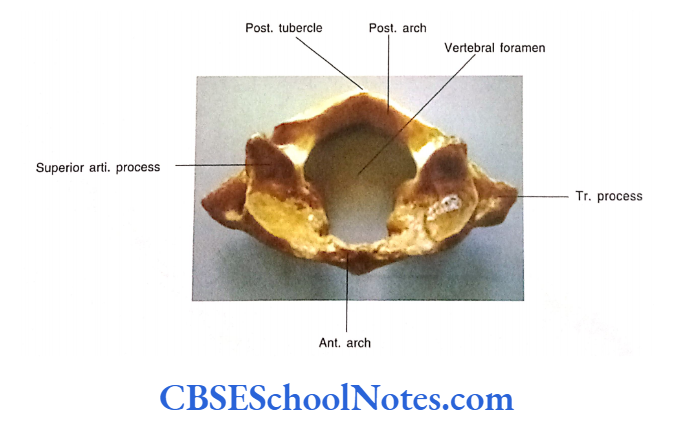 Bones Of The Head And Neck Regions Superior view of 1st cervical vertebra