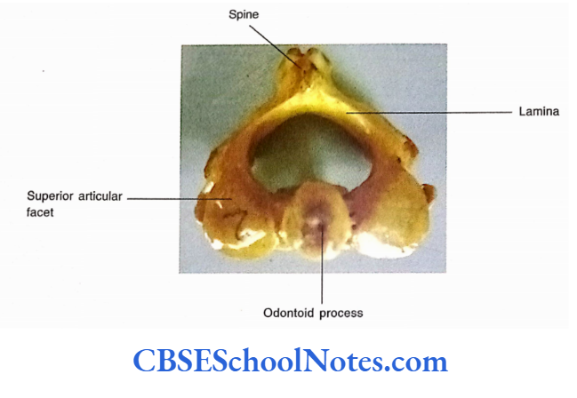 Bones Of The Head And Neck Regions Superior view of 2nd vertebra
