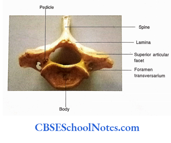 Bones Of The Head And Neck Regions Superior view of 7th cervical vertebra