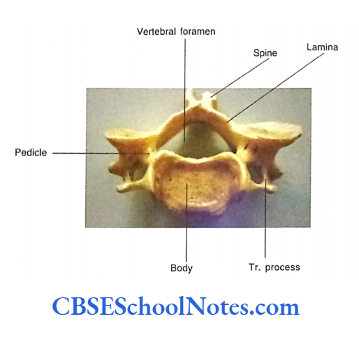 Bones Of The Head And Neck Regions Superior view of typical cervical vertebra