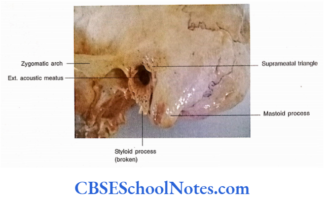 Bones Of The Head And Neck Regions Suprameatal triangle