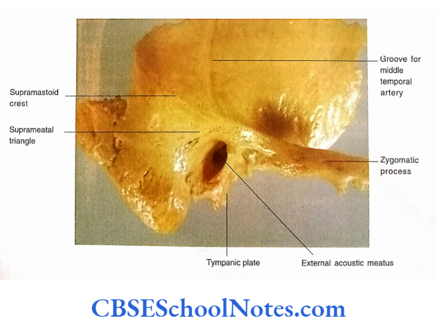 Bones Of The Skull External surface of right temporal bone