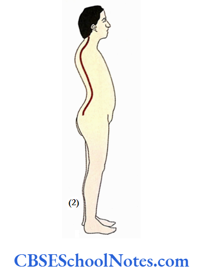 Bones Of The Vertebral Column Lordosis Is An Increase In Lumbar Convexity