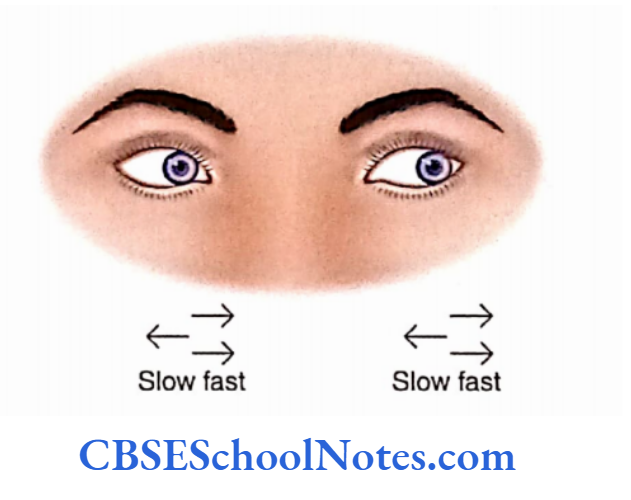 Cerebellum Nystagmus Is A Disorder In Which The Eyes Lose Their Normal Balance And Make Uncontrolled Movements