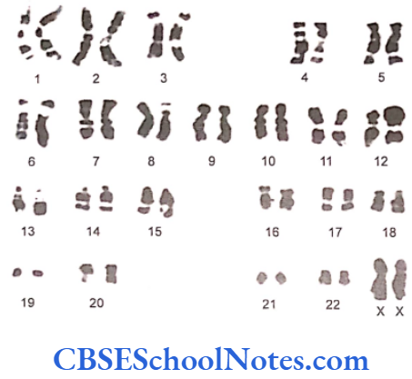 Genetics In Dentistry Chromosomes And Their Classification Female karyotype
