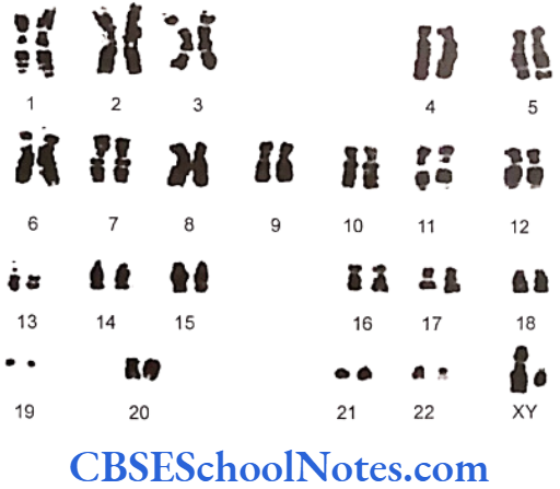 Genetics In Dentistry Chromosomes And Their Classification Male karyotype