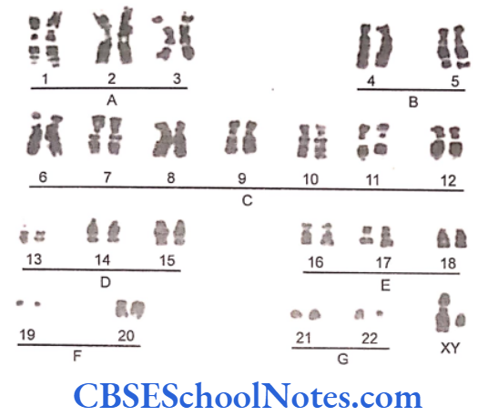 Genetics In Dentistry Chromosomes And Their Classification Photograph of karyotype