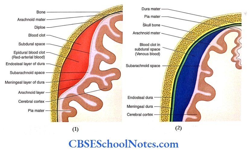 Meninges And Cerebrospinal Intracranial haemorrhage
