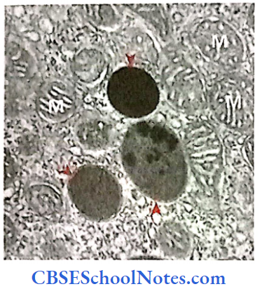 The Cell Structure Electron Micrograph Showing Electron Dense Lysosomes, M-Mitochondrion