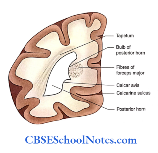Ventricles Of The Brain Coronal section through the posterior horn of the lateral ventricle