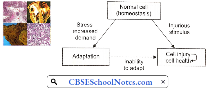 Basic Principles Of Cell Injury And Adaptation Cellular Responses To Stressful Or Injurious Stimuli