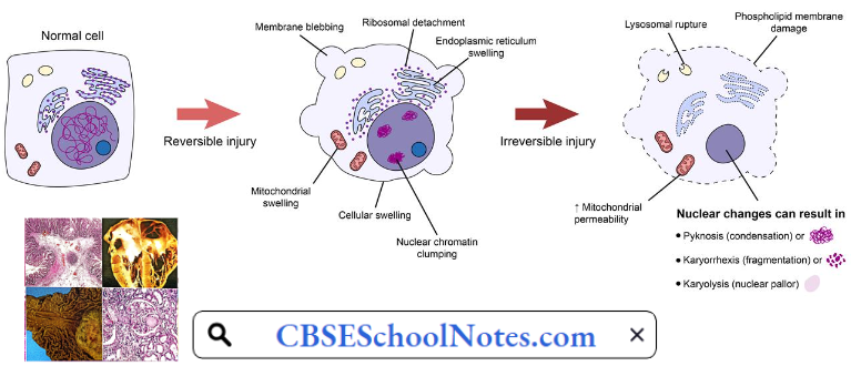 Basic Principles Of Cell Injury And Adaptation Stages Of Response To Cell Injury