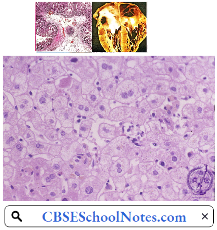 Disorders Of the Gastrointestinal System Histology Liver