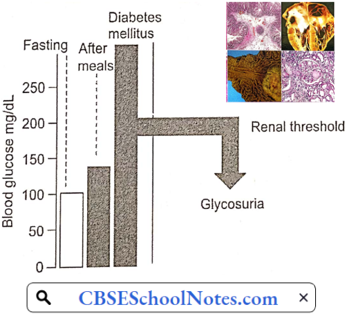 Endocrine Disorders Glycosuria Occurs Only When The Blood Sugar Level Exceeds The Renal Threshold For Glucose