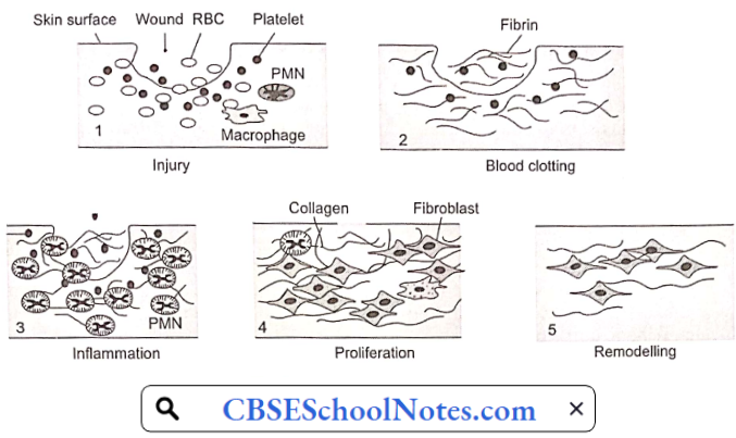 Stages Of Wound Healing