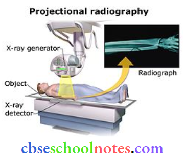 Electromagnetic Waves Projectional Radiography