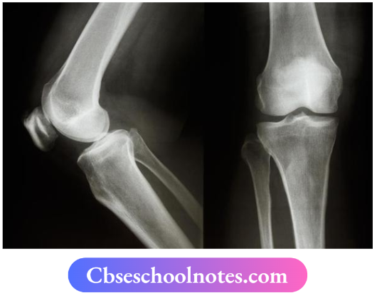CBSE Notes For Class 6 Science Chapter 5 Body Movements X-ray images of ankle and knee joints